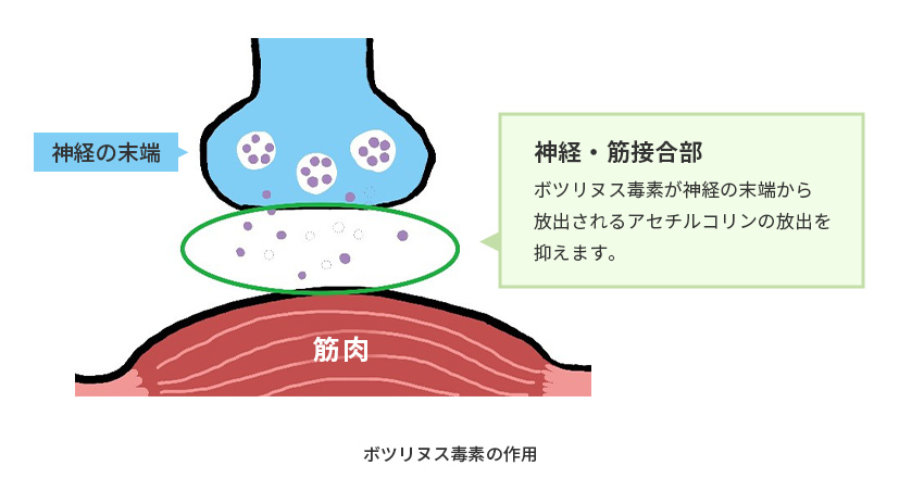 ボツリヌス毒素の作用