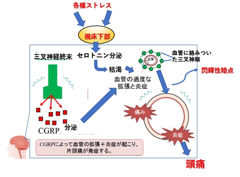 図5 片頭痛の発生メカニズム