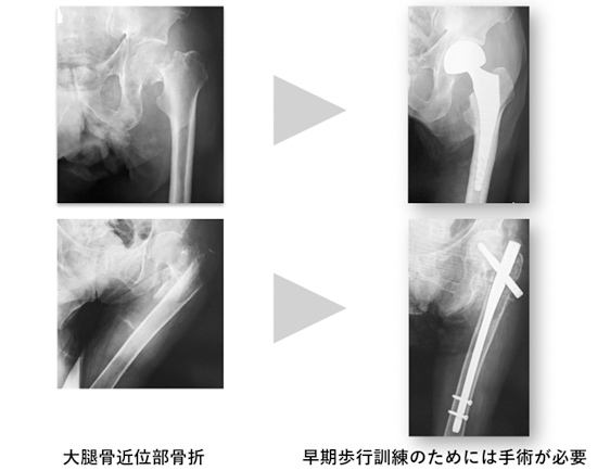 レントゲン画像