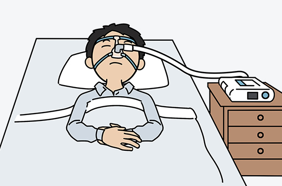 CPAP(シーパップ)療法のイメージイラスト