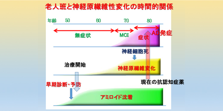 図7 老人班と神経原繊維変化発生の時間的関係