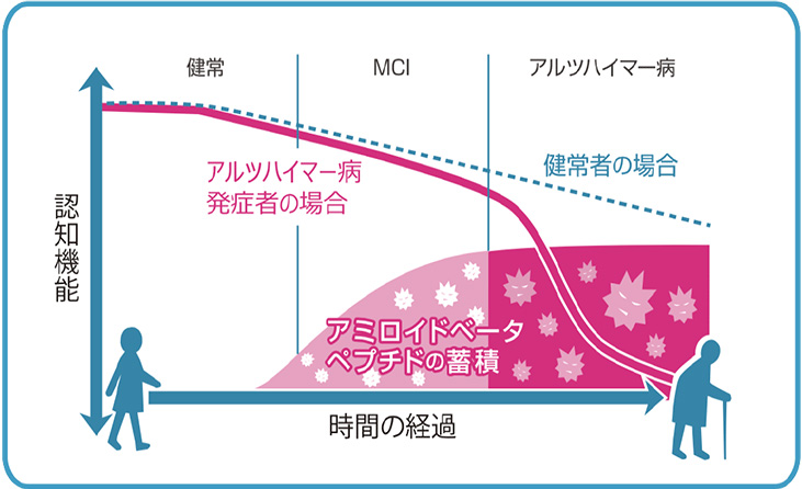 検査は必要なのか