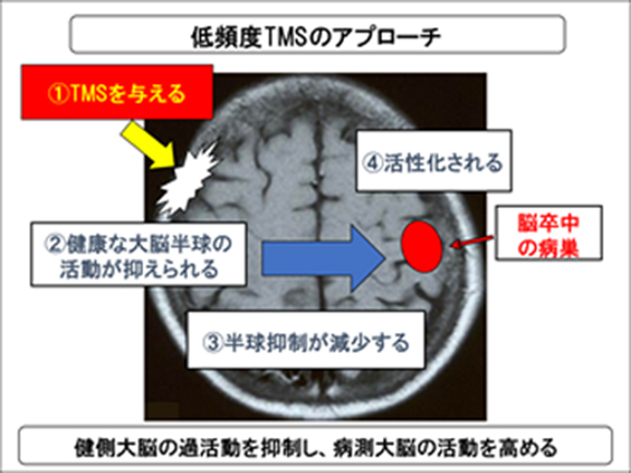 刺激頻度の使い分け