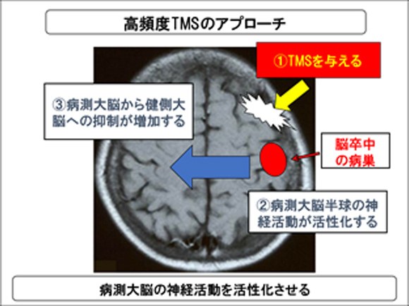 刺激頻度の使い分け